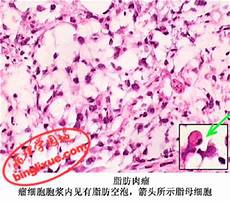 乳腺病的症状中国医师协会乳腺外科医师委员会委员 中国医药教育